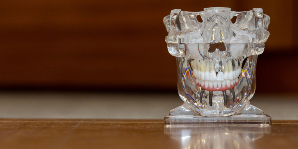 dental implant model