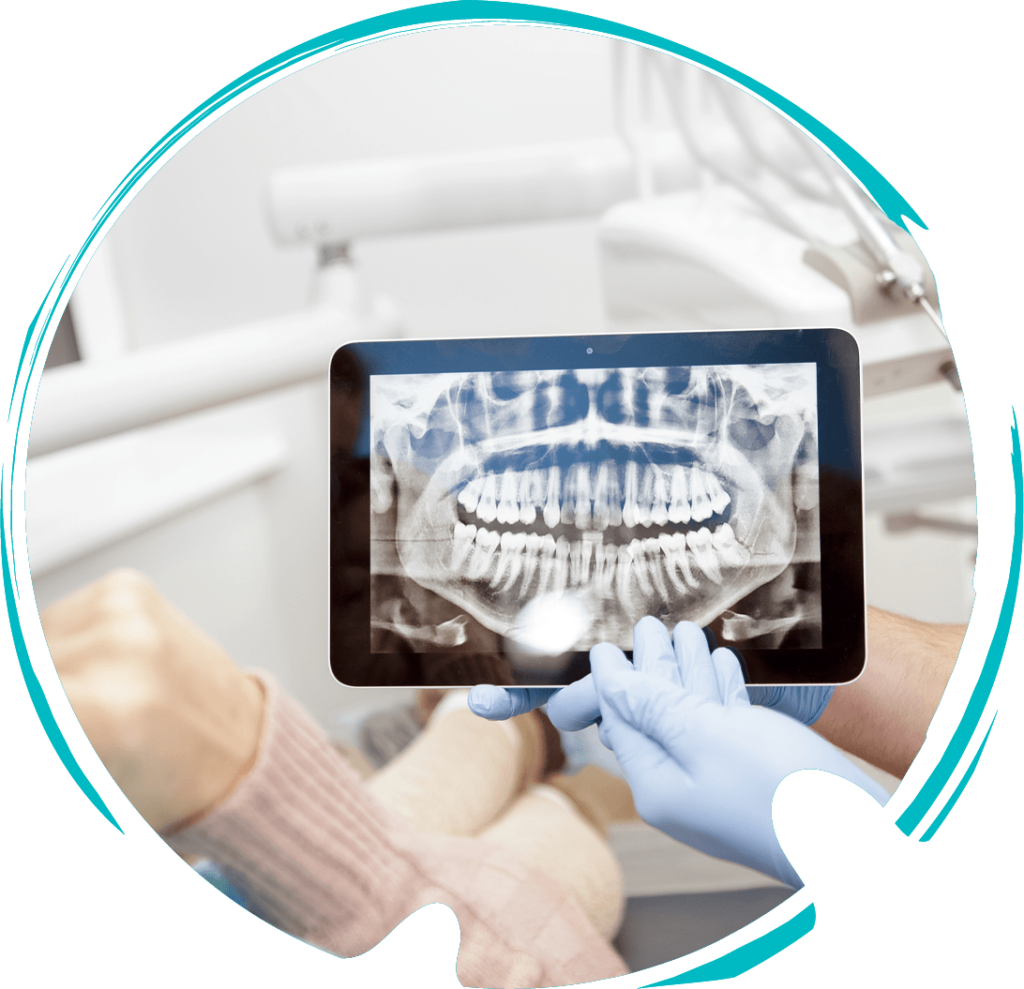 digital dental xray