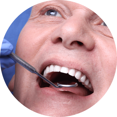 oral cancer screening patient