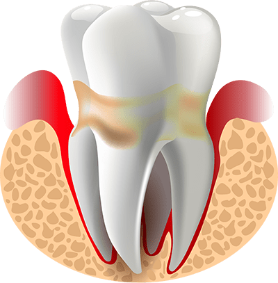 periodontics graphic